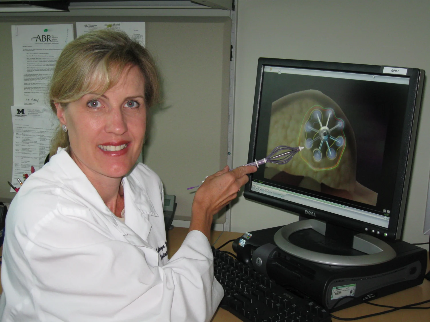 A medical professional holds a breast brachytherapy applicator beside an explanatory image on a monitor.