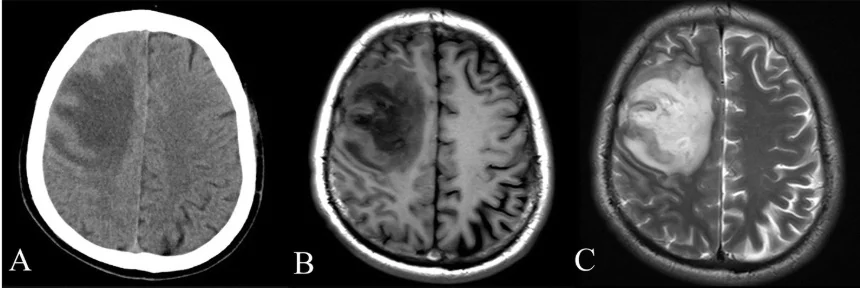 Research images compare CT and MRI sections of the brain.
