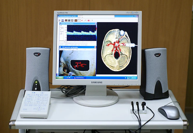 A Doppler ultrasound blood-velocity analyzer with its probes.