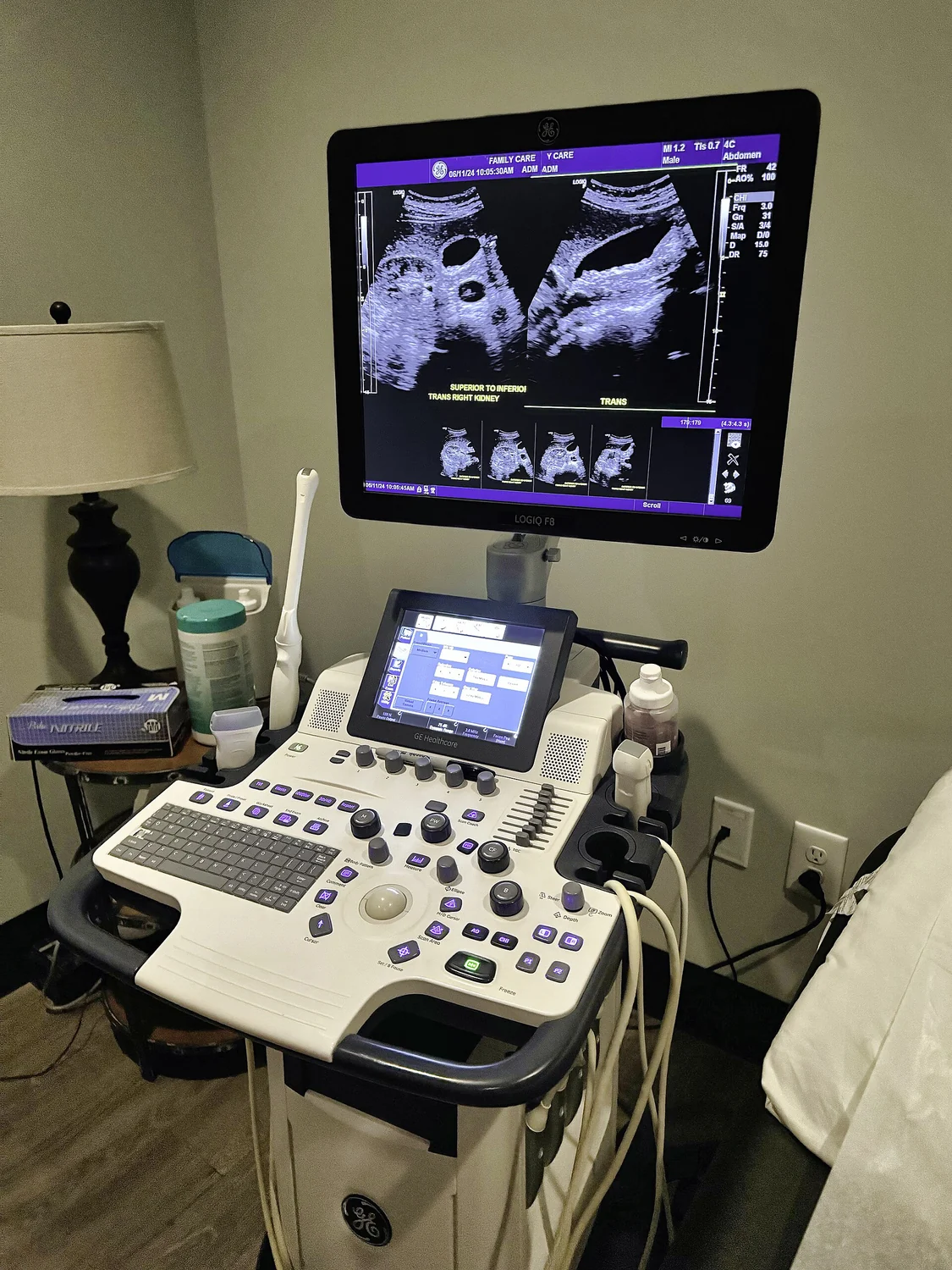 A modern ultrasound scanner with its display, controls, and connected probes.