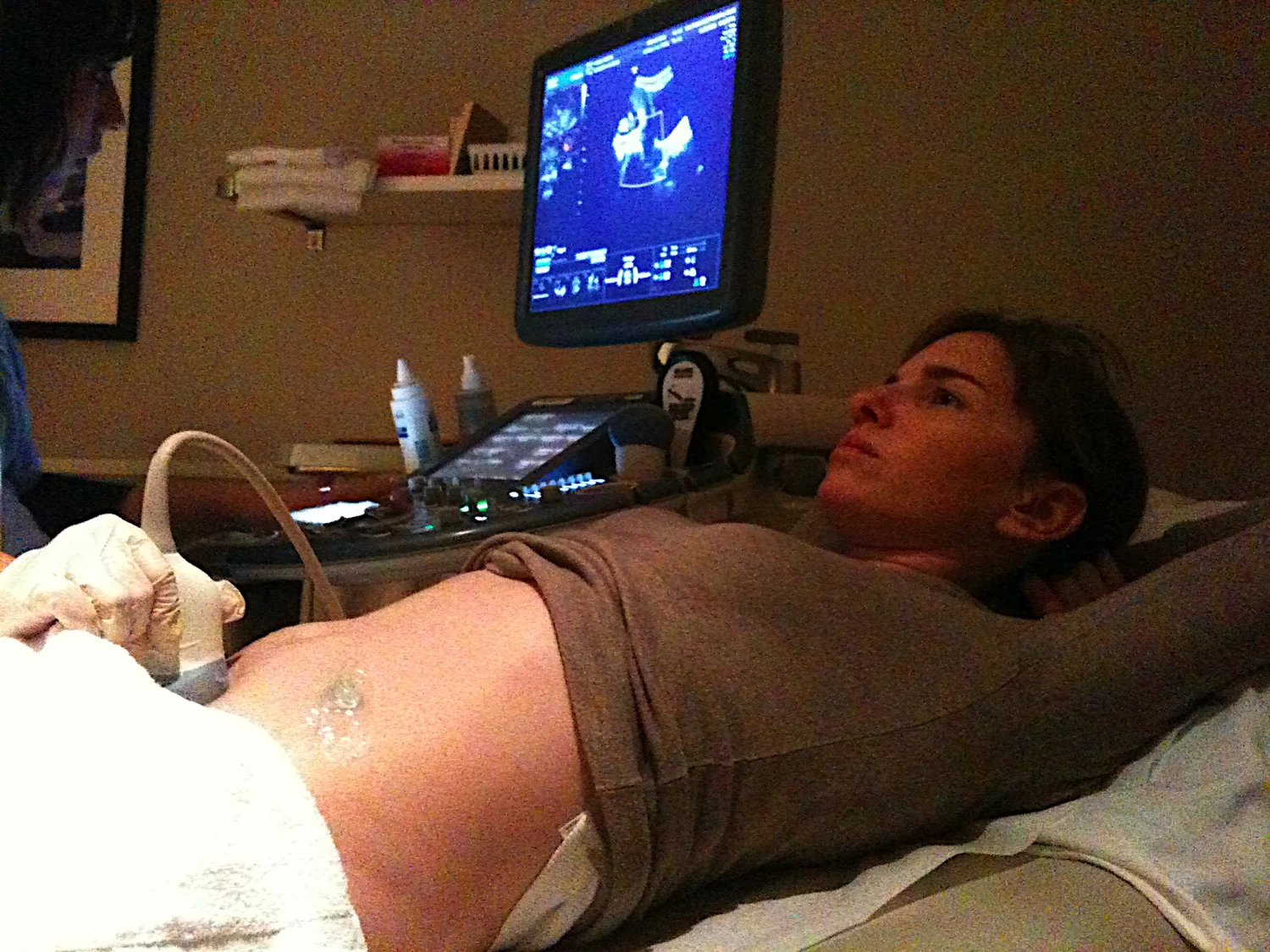 A clinician positions an ultrasound probe on a pregnant woman’s abdomen.