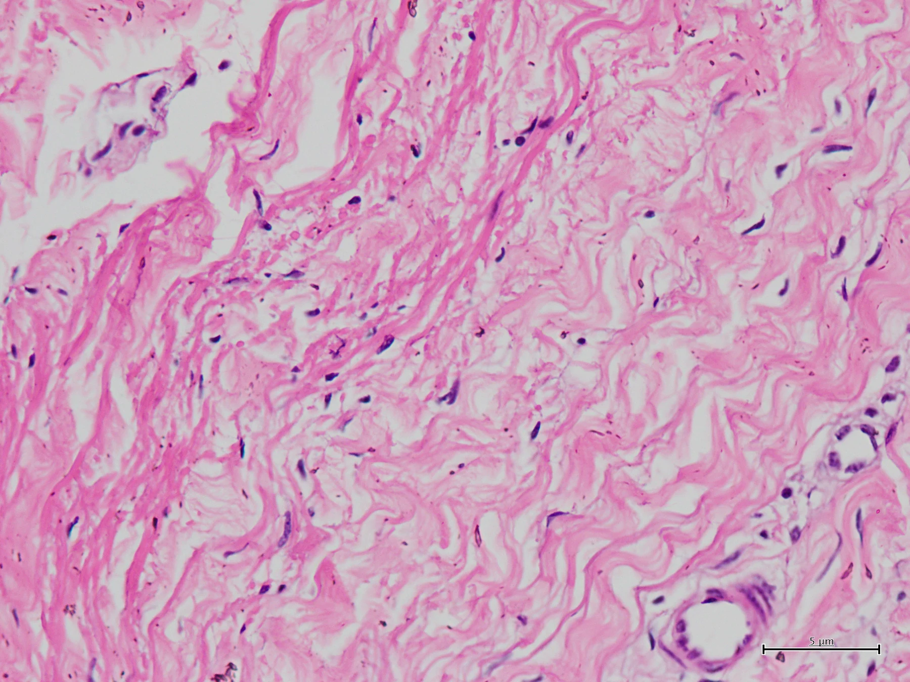 A pink-stained light micrograph reveals wavy layers of bovine pericardial tissue.