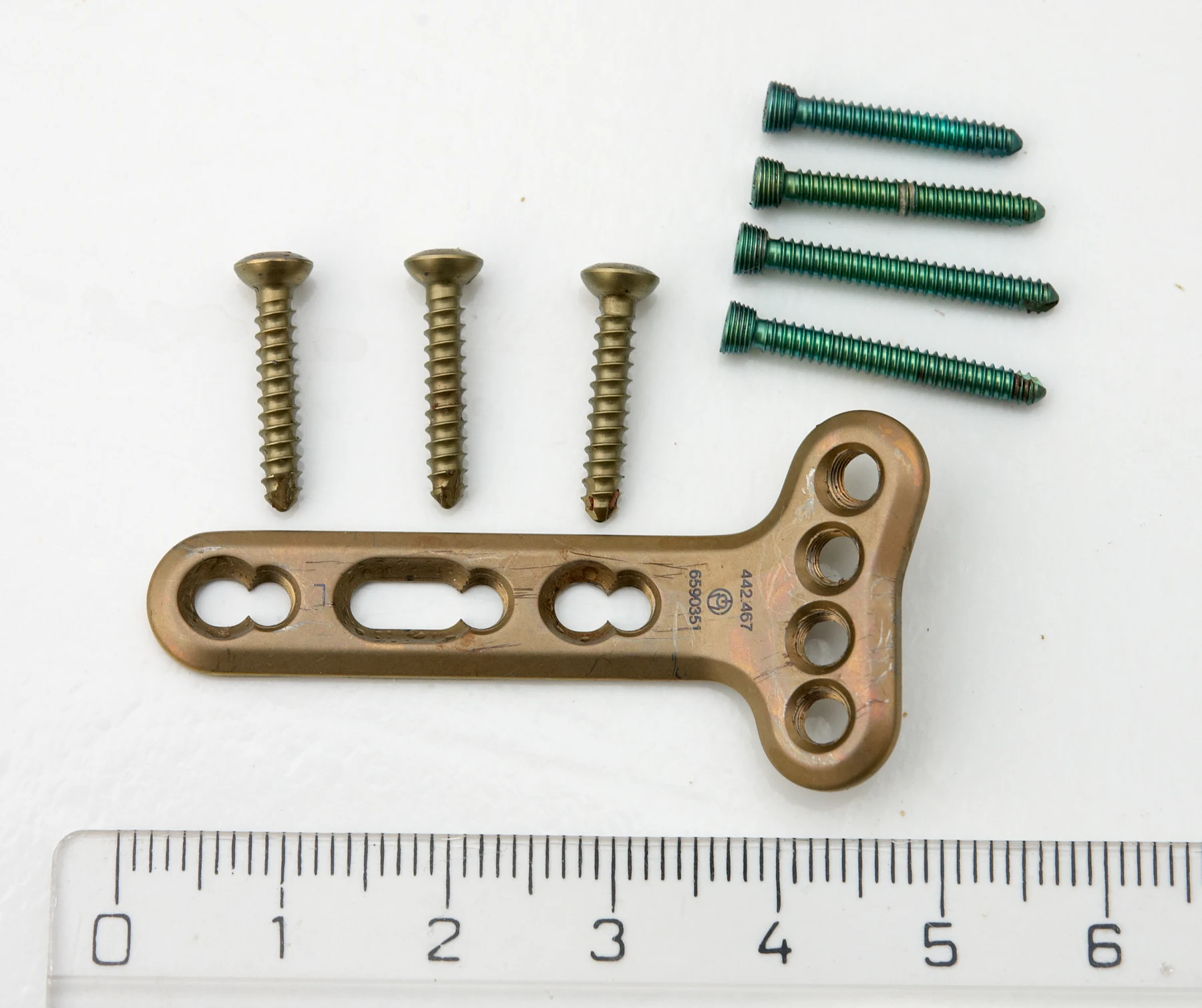 A small titanium fixation plate and several screws are arranged above a metric ruler.